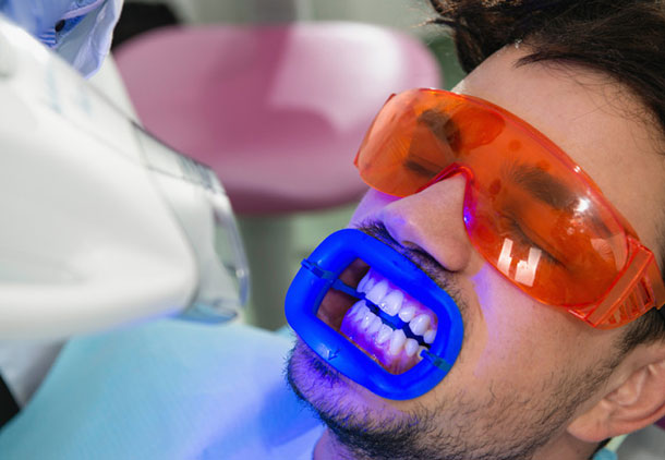 معایب کامپوزیت دندانپزشکی چیست؟