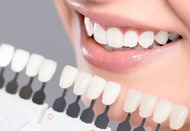 بهترین مارک کامپوزیت دندانپزشکی چیست؟
