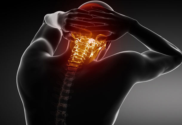 درد پشت سر به دلیل سردردهای آرتریتی