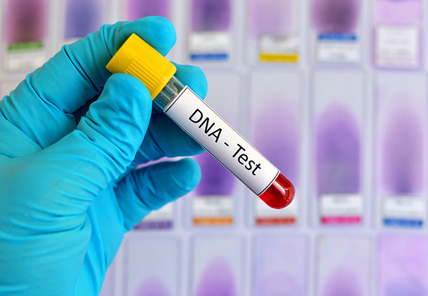 آزمایش DNA