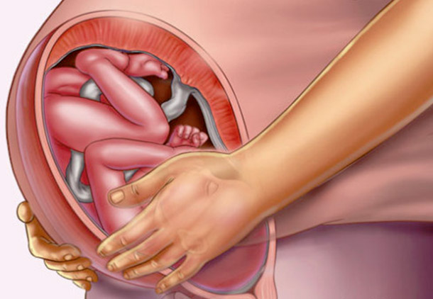 شل شدن عضلات ناحیه لگن در هفته سی و ششم بارداری