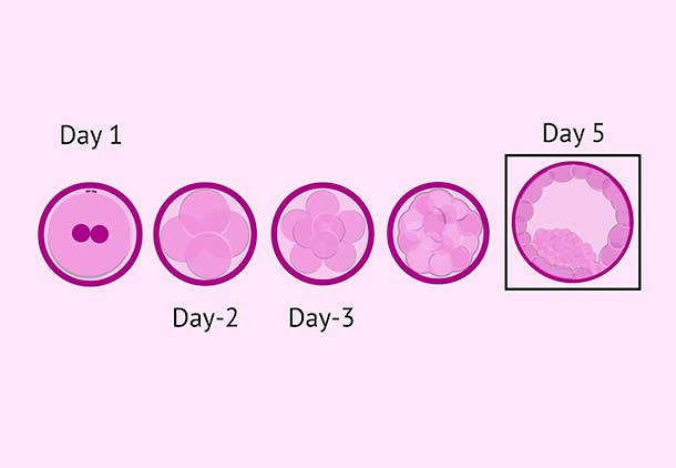 لقاح خارج رحمی (IVF) : مرحله چهارم : کشت جنین