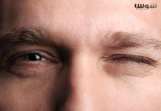 تیک عصبی چشم (درمان خانگی تیک عصبی + علت تیک چشم) تیک عصبی چشم (درمان خانگی تیک عصبی + علت تیک چشم)