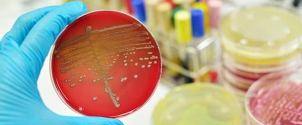 استافیلوکوک اورئوس مقاوم به متیسیلین : مقاومت به آنتی بیوتیک ها