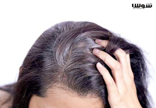 10 فرمول جدید جلوگیری از سفید شدن مو 10 فرمول جدید جلوگیری از سفید شدن مو