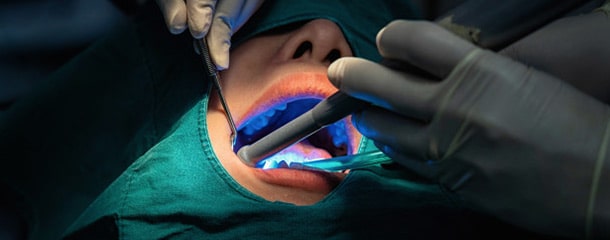 ایمپلنت دندان : ایمپلنت دندان چقدر موفق است؟