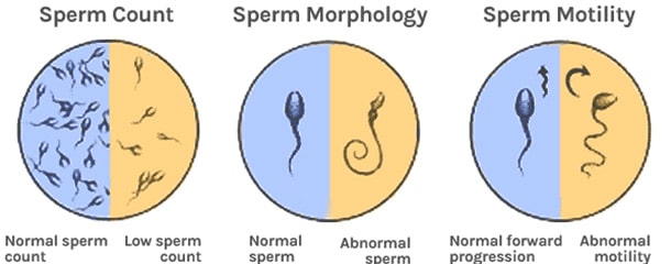 آزمایش اسپرم : نتایج آزمایش اسپرم مردان