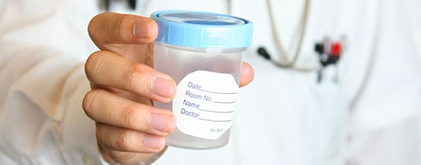 آزمایش اسپرم : آزمایش اسپرم چگونه است