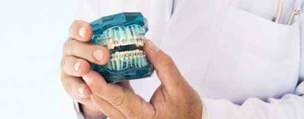 مراحل ارتودنسی دندان :  قسمت ششم مراحل ارتودنسی دندان : نگهداری و معاینات