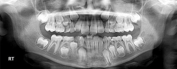 مراحل ارتودنسی دندان : قسمت اول مراحل ارتودنسی دندان : معاینات اولیه