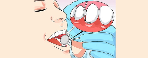 علت قرمز شدن لثه ها بعد از استفاده لوازم دندانپزشکی