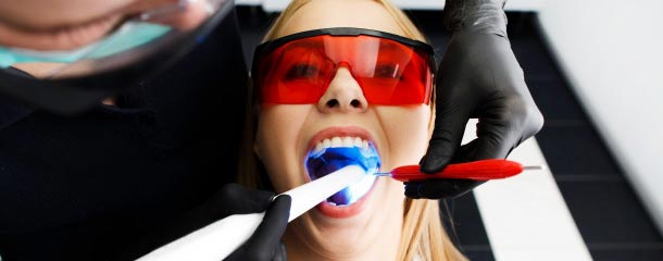 از بین بردن لک دندان توسط بلیچینگ دندان