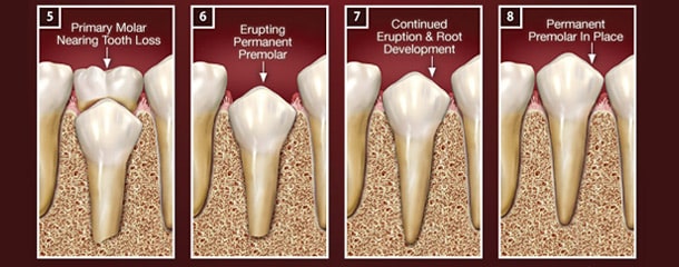 عصب کشی دندان شیری : ریشه دندان شیری