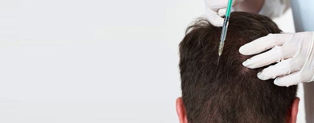 مزوتراپی مو : تأثیرات مزوتراپی مو به چه صورتی دیده می‌شود؟
