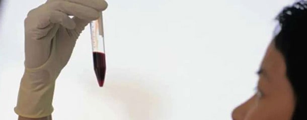 واکسن مالاریا : آزمایش خون