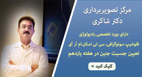 سونوگرافی دکتر شاکری در تهران