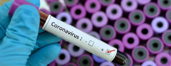 کرونا ویروس : آیا باید برای ویروس کورونا nCoV) Corona virus 2019) تست انجام شود؟