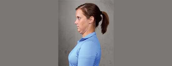 ورزش برای گردن درد : ورزش انقباض گردن در حالت نشسته یا ایستاده