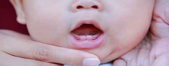 سوختگی-پای-نوزاد-(علت،-علائم-و-درمان-سوختگی-لای-پای-نوزاد)