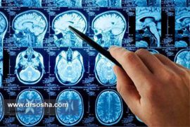 بهترین متخصص مغز و اعصاب در کرمان